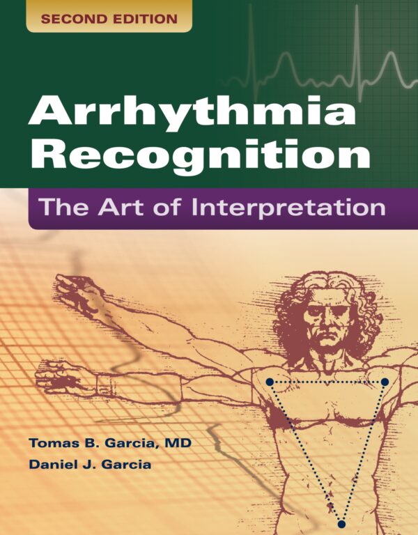 Mastering Ecg Interpretation: A Comprehensive Guide To Arrhythmia Recognition (2Nd Edition)