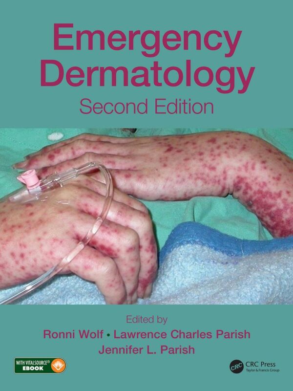 Emergency Dermatology: A Practical Guide To Diagnosis And Management (2Nd Edition)