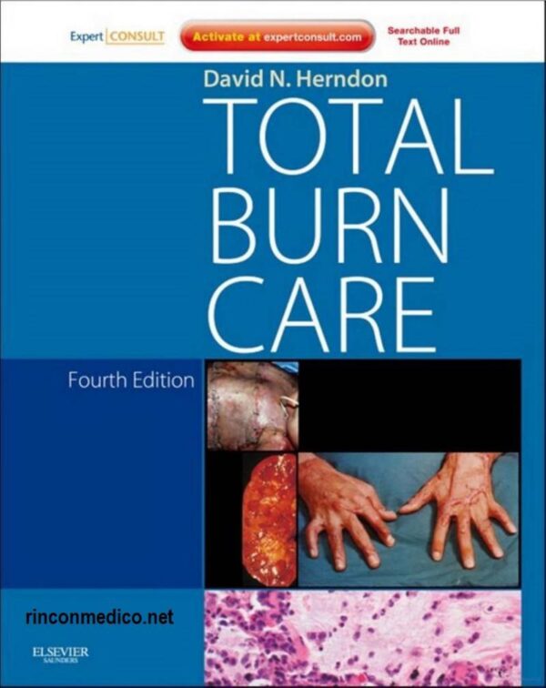 Total Burn Care: A Comprehensive Guide (4Th Edition)