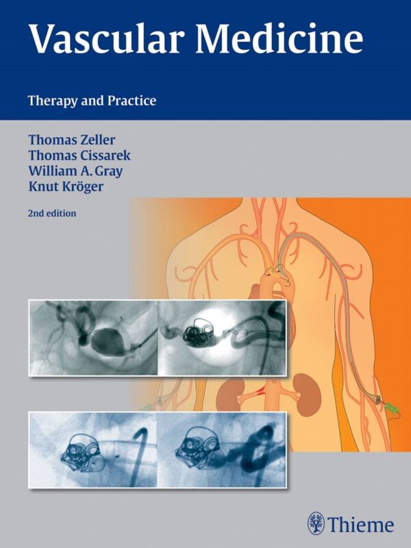 Evidence-Based Vascular Medicine: Therapy And Practice (2Nd Edition)